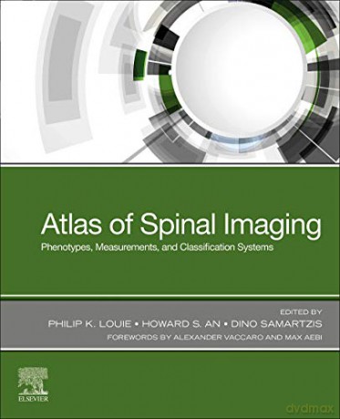 Atlas of Spinal Imaging: Phenotypes, Measurements and Classification Systems - Philip K. Louie MD [KSIĄŻKA]