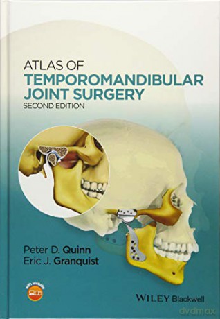 Atlas of Temporomandibular Joint Surgery - Peter D. Quinn [KSIĄŻKA]