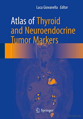Atlas of Thyroid and Neuroendocrine Tumor Markers - Luca Giovanella [KSIĄŻKA]