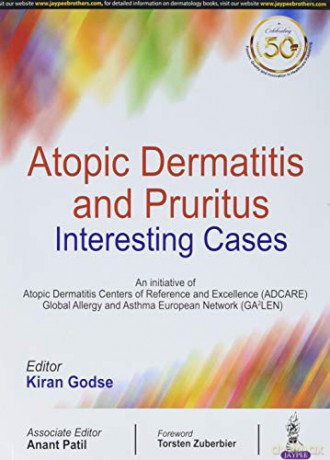 Atopic Dermatitis and Pruritus-Interesting Cases - Kiran Godse [KSIĄŻKA]