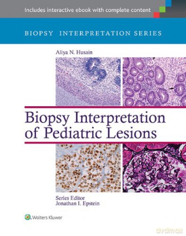 Biopsy Interpretation of Pediatric Lesions (Biopsy Interpretation Series) - Aliya N. Husain [KSIĄŻKA]
