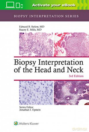 Biopsy Interpretation of the Head and Neck (Biopsy Interpretation Series) - Edward B. Stelow [KSIĄŻKA]