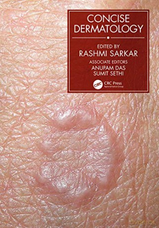 Concise Dermatology - Rashmi Sarkar [KSIĄŻKA]
