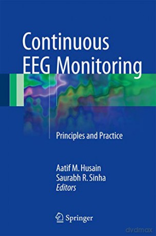 Continuous EEG Monitoring: Principles and Practice - Aatif M. Husain [KSIĄŻKA]