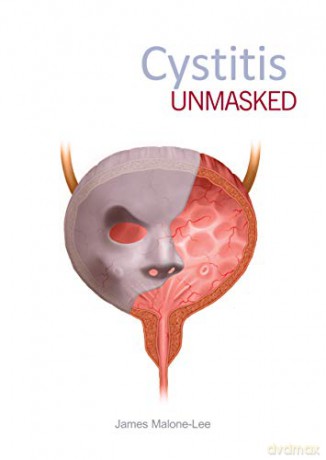 Cystitis Unmasked - James Malone-Lee [KSIĄŻKA]