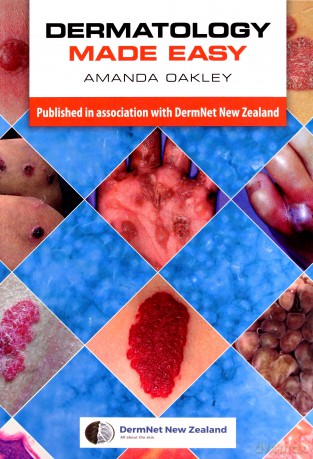 Dermatology Made Easy - Amanda Oakley [KSIĄŻKA]