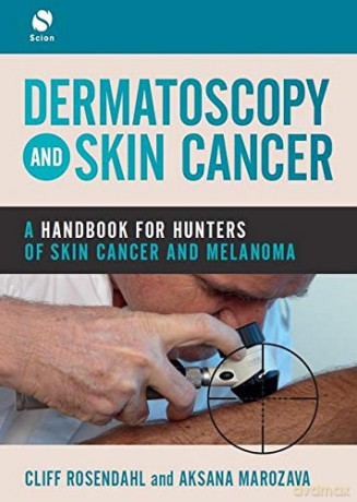 Dermatoscopy and Skin Cancer: A handbook for hunters of skin cancer and melanoma - Cliff Rosendahl [KSIĄŻKA]