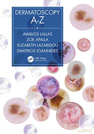 Dermatoscopy A-Z - Aimilios Lallas [KSIĄŻKA]
