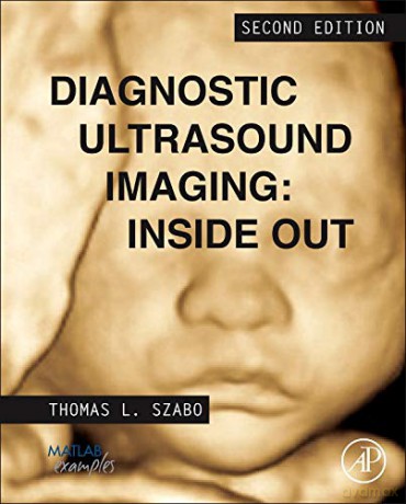 Diagnostic Ultrasound Imaging: Inside Out (Biomedical Engineering) - Thomas L. Szabo [KSIĄŻKA]