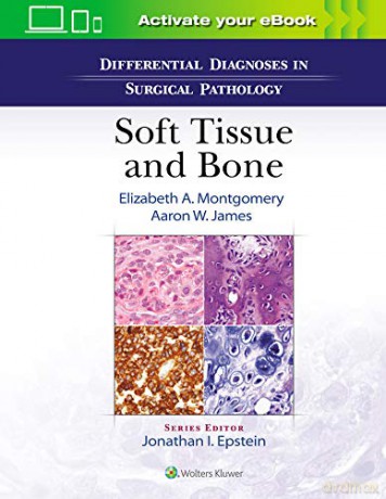 Differential Diagnoses in Surgical Pathology: Soft Tissue and Bone - Elizabeth A. Montgomery [KSIĄŻKA]