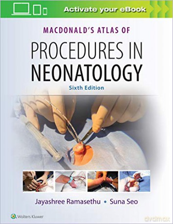 MacDonald's Atlas of Procedures in Neonatology - Jayashree Ramasethu [KSIĄŻKA]