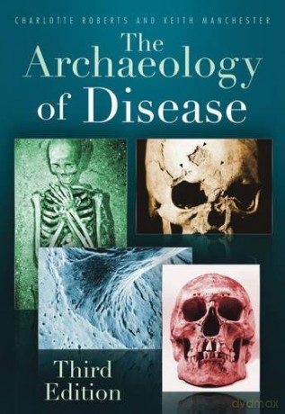 The Archaeology of Disease: Third Edition - Charlotte Roberts [KSIĄŻKA]