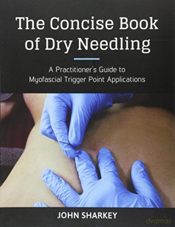The Concise Book of Dry Needling: Practical Applications for Myofascial Trigger Point Therapy: A Practitioner's Guide to Myofascial Trigger Point Applications - John Sharkey [KSIĄŻKA]