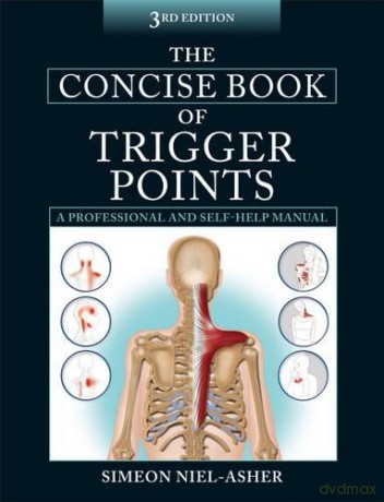 The Concise Book of Trigger Points - Simeon Niel-Asher [KSIĄŻKA]