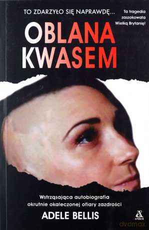 Oblana kwasem wyd. 3 - Adele Bellis [KSIĄŻKA]