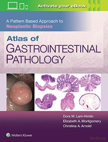 Atlas of Gastrointestinal Pathology: A Pattern Based Approach to Neoplastic Biopsies - Christina Arnold [KSIĄŻKA]