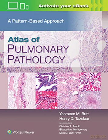 Atlas of Pulmonary Pathology: A Pattern Based Approach - Butt [KSIĄŻKA]