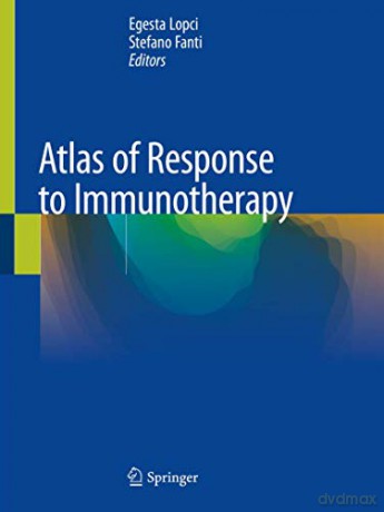 Atlas of Response to Immunotherapy - Egesta Lopci [KSIĄŻKA]