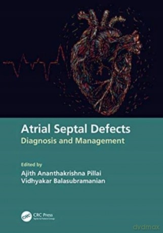 Atrial Septal Defects: Diagnosis and Management - Ajith Ananthakrishna Pillai [KSIĄŻKA]
