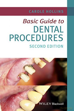 Basic Guide to Dental Procedures Basic Guide Dentistry Series - Carole Hollins [KSIĄŻKA]