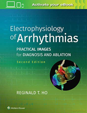 Electrophysiology Of Arrhythmias: Practical Images For Diagnosis And Ablation - Reginald T. Ho [KSIĄŻKA]