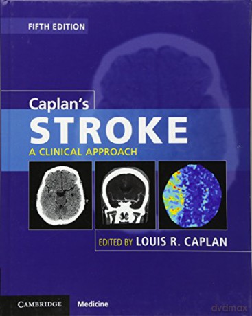 Caplan's Stroke: A Clinical Approach - Louis R. Caplan [KSIĄŻKA]