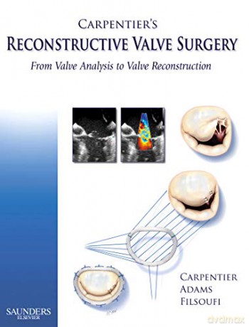 Carpentier's Reconstructive Valve Surgery - Alain Carpentier MD PhD [KSIĄŻKA]