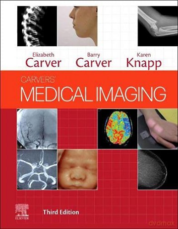 Carvers' Medical Imaging - Karen Knapp [KSIĄŻKA]