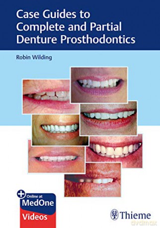 Case Guides to Complete and Partial Denture Prosthodontics - Robin Wilding [KSIĄŻKA]