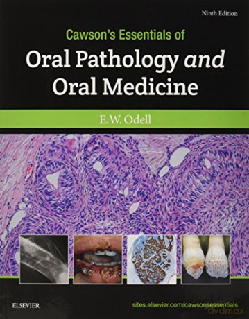 Cawson's Essentials of Oral Pathology and Oral Medicine, 9e - Edward W Odell FDSRCS MSc PhD FRCPath [KSIĄŻKA]