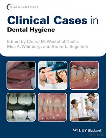Clinical Cases in Dental Hygiene Clinical Cases Dentistry - Stuart L. Segelnick [KSIĄŻKA]