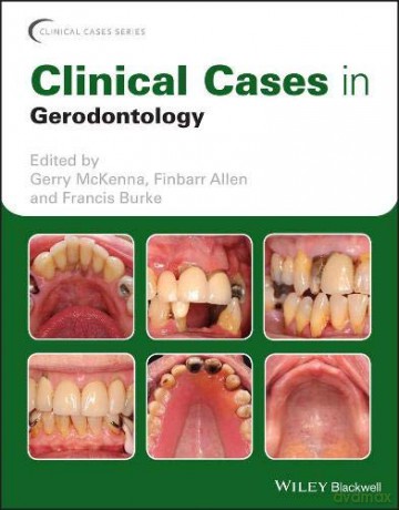 Clinical Cases in Gerodontology Clinical Cases Dentistry - Gerry McKenna [KSIĄŻKA]