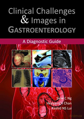 Clinical Challenges and Images in Gastroenterology: A Diagnostic Guide - S Ng [KSIĄŻKA]