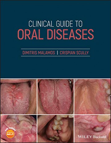 Clinical Guide to Oral Diseases - Crispian Scully [KSIĄŻKA]