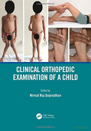 Clinical Orthopedic Examination of a Child - Nirmal Raj Gopinathan [KSIĄŻKA]
