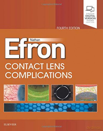 Contact Lens Complications, 4e: Expert Consult - Online and Print [KSIĄŻKA]
