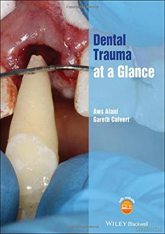 Dental Trauma at a Glance At a Glance Dentistry - Aws Alani [KSIĄŻKA]