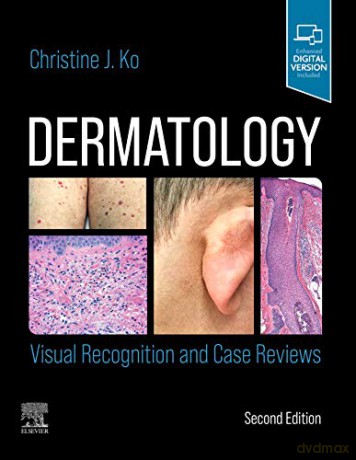 Dermatology: Visual Recognition and Case Reviews - Christine J. Ko MD [KSIĄŻKA]