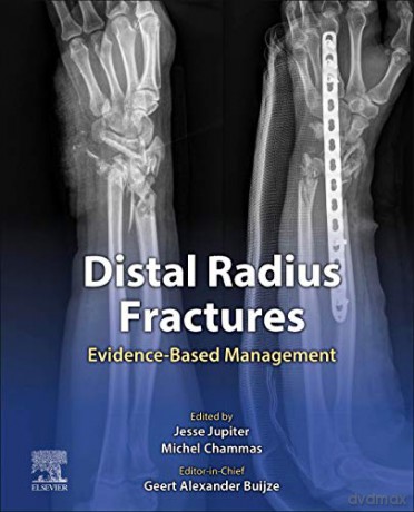 Distal Radius Fractures: Evidence-Based Management - Geert Alexander Buijze MD PhD Hand Surgeon [KSIĄŻKA]