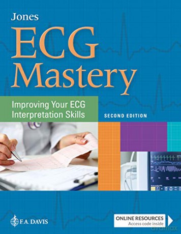 ECG Mastery: Improving Your ECG Interpretation Skills [KSIĄŻKA]