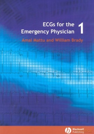 ECGs for the Emergency Physician 1: Level 1 - Amal Mattu [KSIĄŻKA]