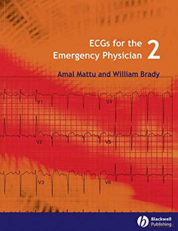 ECGs for the Emergency Physician 2 - Amal Mattu [KSIĄŻKA]