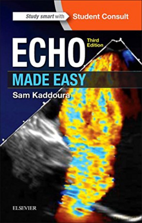 Echo Made Easy, 3e [KSIĄŻKA]
