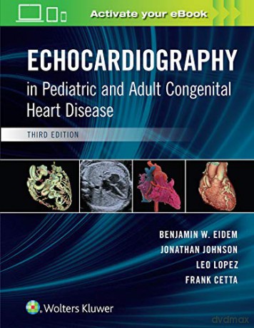 Echocardiography in Pediatric and Adult Congenital Heart Disease - Benjamin W. Eidem MD FACC FASE [KSIĄŻKA]