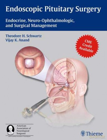 Endoscopic Pituitary Surgery: Endocrine, Neuro-Ophthalmologic, And Surgical Management - Theodore Schwartz [KSIĄŻKA]