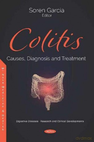 Colitis: Causes, Diagnosis And Treatment - Soren Garcia [KSIĄŻKA]