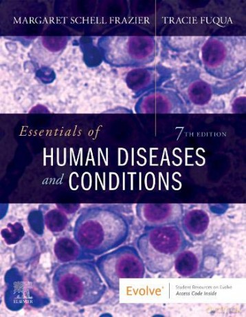 Essentials of Human Diseases and Conditions - Margaret Schell Frazier RN CMA BS [KSIĄŻKA]