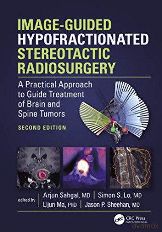 Image-Guided Hypofractionated Stereotactic Radiosurgery: A Practical Approach To Guide Treatment Of Brain And Spine Tumors - Arjun Sahgal [KSIĄŻKA]