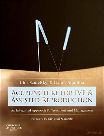 Acupuncture For Ivf And Assisted Reproduction: An Integrated Approach To Treatment And Management, 1E [KSIĄŻKA]