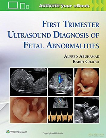 First Trimester Ultrasound Diagnosis of Fetal Abnormalities - Alfred Z. Abuhamad [KSIĄŻKA]